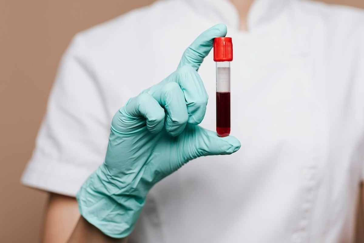 Prever o futuro? Cientistas dos EUA criam exame de sangue que detecta câncer de cabeça e pescoço até 10 anos antes dos sintomas