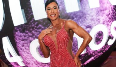 Gracyanne Barbosa passará por cirurgia após acidente na Globo
