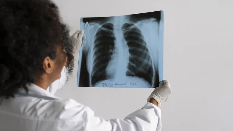 Envelhecimento afeta função dos pulmões; saiba como testar "idade" pulmonar