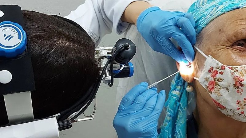 Como cera de ouvido pode ajudar na detecção precoce do câncer