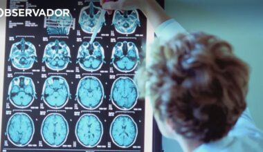 Portuguesas descobrem medicamento que pode travar Alzheimer – Observador
