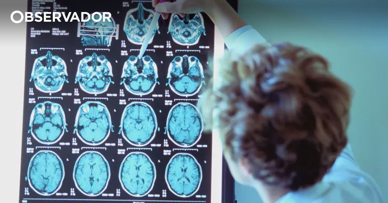 Portuguesas descobrem medicamento que pode travar Alzheimer – Observador