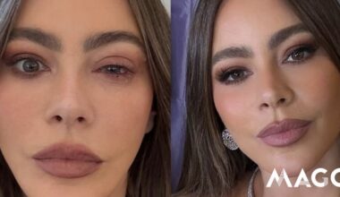 Sofia Vergara foi parar ao hospital momentos antes dos Emmys. Atriz teve uma reação alérgica severa - Celebridades