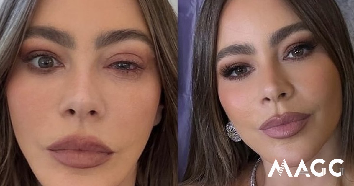 Sofia Vergara foi parar ao hospital momentos antes dos Emmys. Atriz teve uma reação alérgica severa - Celebridades