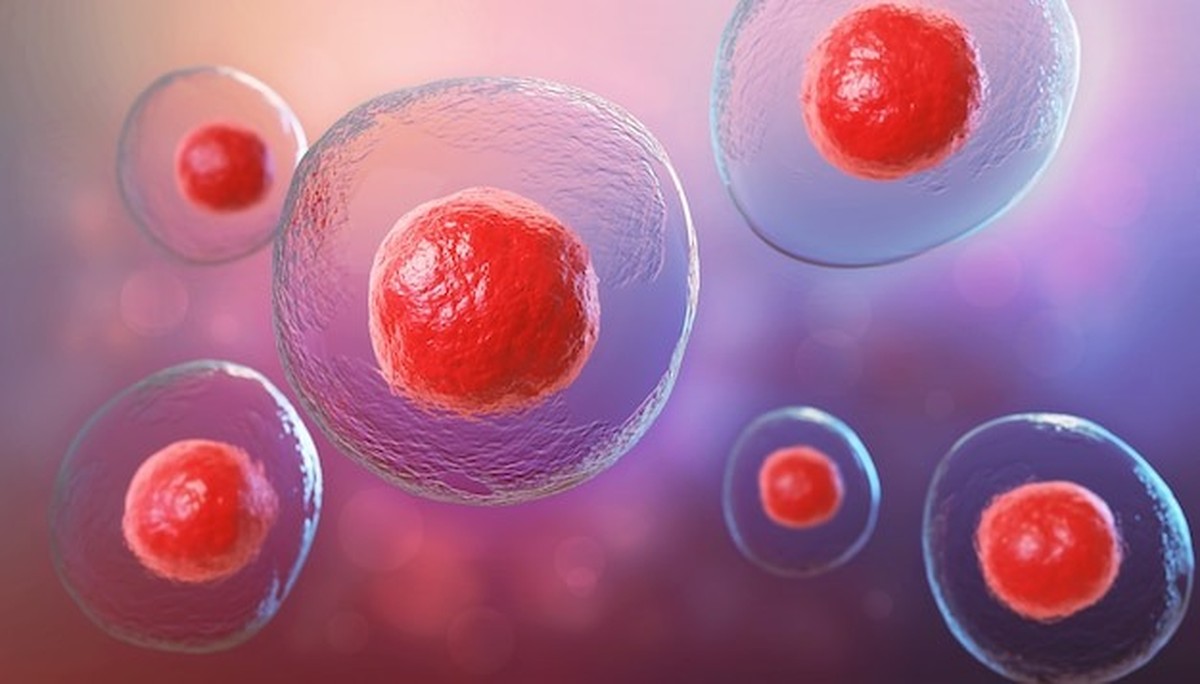 Transplante de células-tronco usado em derrames fez crescer células cerebrais da área lesionada, mostra novo estudo da Nature
