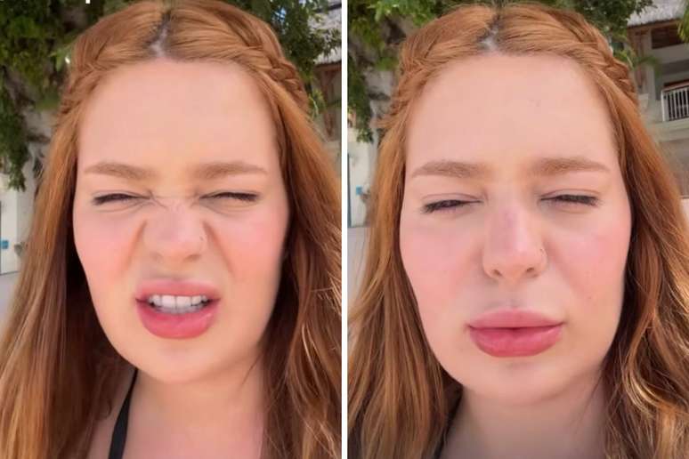 Viih Tube reclama de falta de expressão após botox