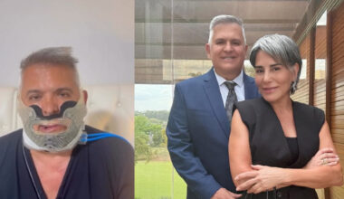 Após cirurgia no rosto, Orlando Morais surge em vídeo e revela dificuldades
