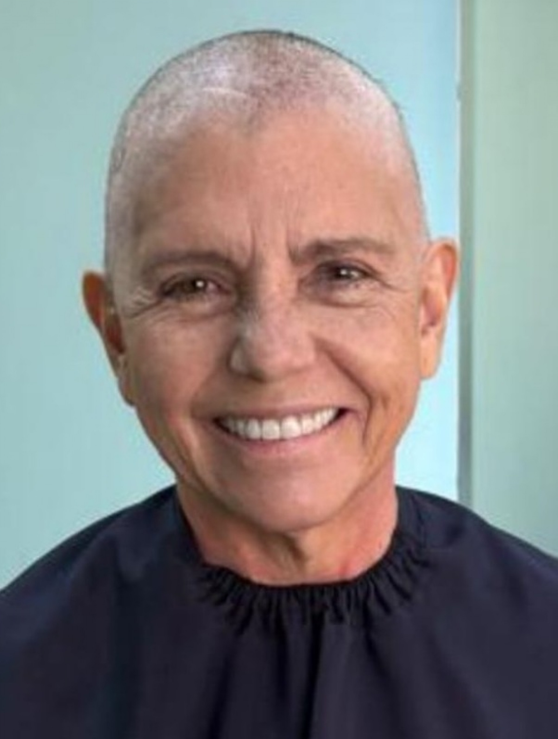 Com câncer, Roseana Sarney publicou foto com cabeça raspada