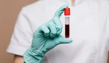 Cientistas criam exame de sangue que detecta câncer de cabeça e pescoço até 10 anos antes dos sintomas