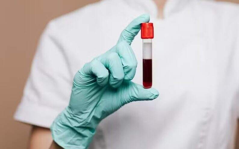Cientistas criam exame de sangue que detecta câncer de cabeça e pescoço até 10 anos antes dos sintomas