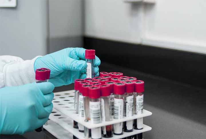 Elas também atuam na redução dos níveis de colesterol LDL, também conhecido como o colesterol “ruim” e
ajudam a regular os níveis de açúcar no sangue, fator importante para quem possui quadro de diabetes, sobretudo a mellitus (tipo 2).
-Imagem Pixabay
