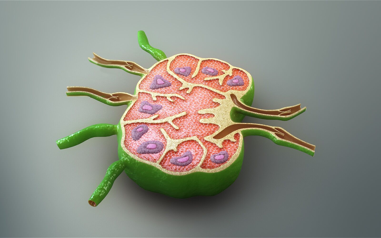 Cortar gânglios linfáticos: novo estudo questiona método comum de tratamento do cancro