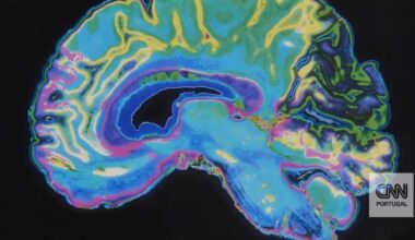 Cientistas visualizam pela primeira vez proteínas que desencadeiam Parkinson