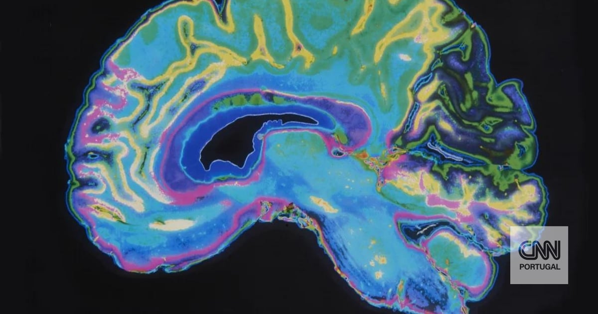 Cientistas visualizam pela primeira vez proteínas que desencadeiam Parkinson