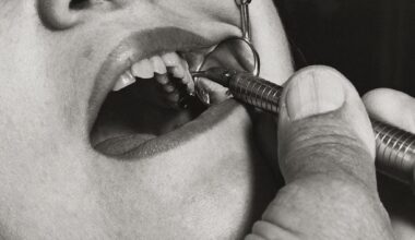 Cancro oral: "a prevenção e o diagnóstico precoce são a chave"