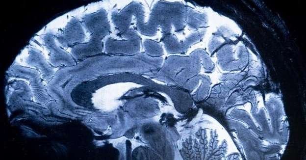OMS pede atenção urgente à saúde cerebral