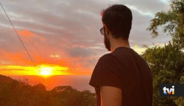 Finalista do Big Brother submete-se a transplante capilar e surge irreconhecível - Secret Story