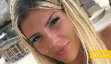 Cristiana Jesus passa por mudança drástica no rosto: "Demora até um ano..."