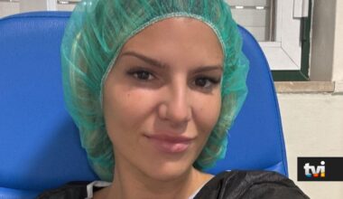 Cristiana Jesus mostra mudança impressionante no seu rosto após intervenção estética - Secret Story