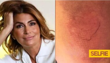 Perna de Liliana Campos com "péssimo aspeto"