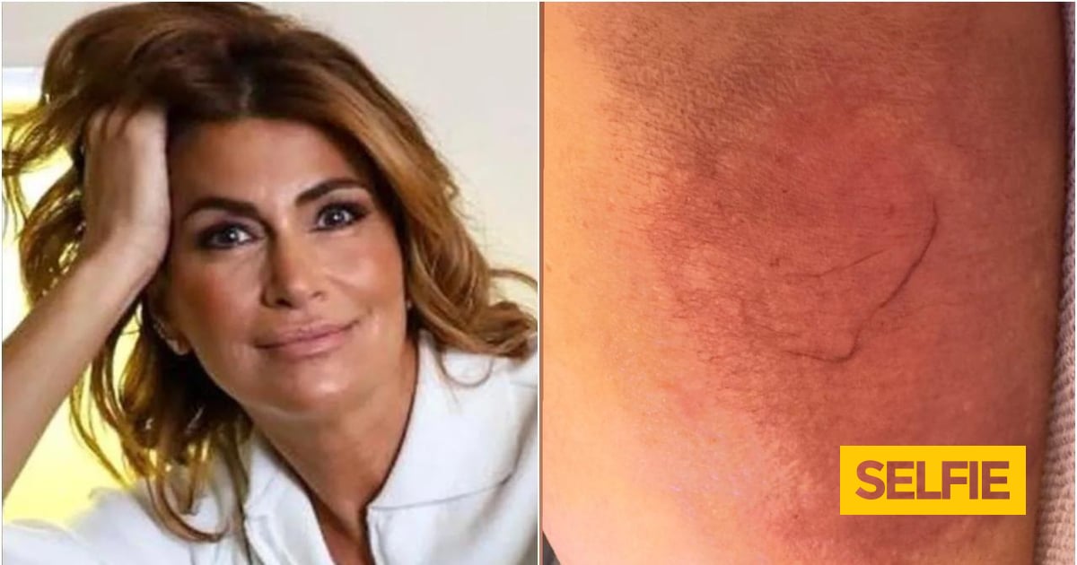 Perna de Liliana Campos com "péssimo aspeto"