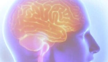 AVC mata uma pessoa a cada seis minutos no Brasil