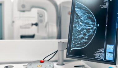 Mulheres com 40 anos podem fazer mamografia pelo SUS? Entenda a nova recomendação do Ministério da Saúde