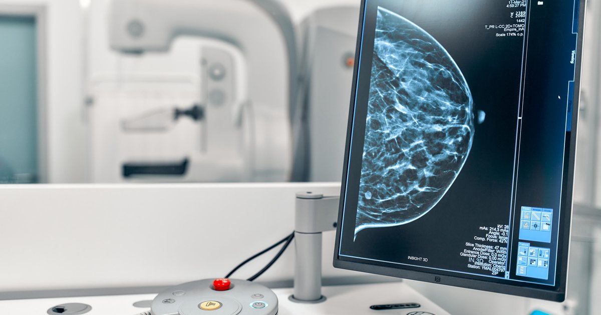 Mulheres com 40 anos podem fazer mamografia pelo SUS? Entenda a nova recomendação do Ministério da Saúde