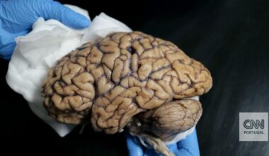 Análise de sangue pode detetar doença de Parkinson antes dos sintomas