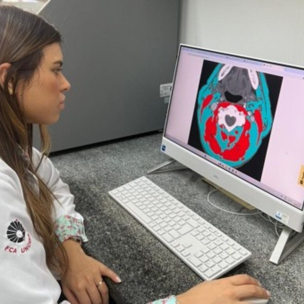 Gordura e massa muscular ajudam a prolongar a vida de pacientes com câncer