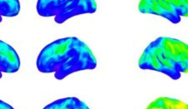 Neuroinflamação em síndrome de Down explica alta prevalência de Alzheimer