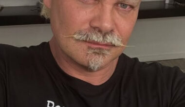 Carmo Dalla Vecchia transforma sorriso após receber crítica sobre aparência | Celebridades