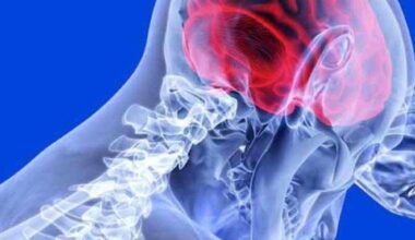 Reabilitação após AVC deve começar em até 48 horas para reduzir sequelas