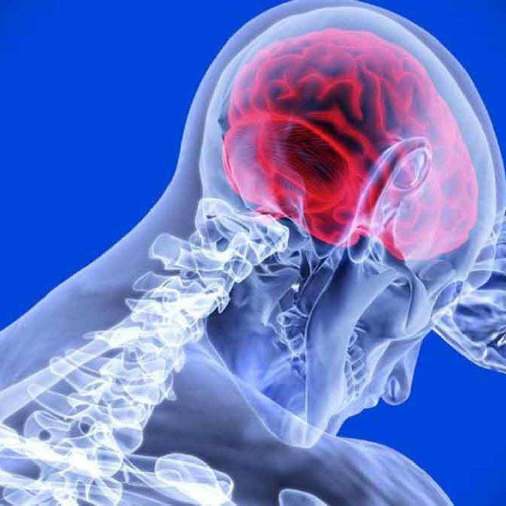 Reabilitação após AVC deve começar em até 48 horas para reduzir sequelas