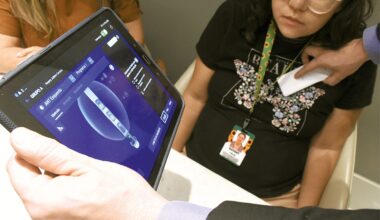 Implante cerebral promete reduzir crises de epilepsia em 50%