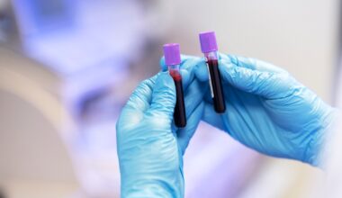 Estudo revela em que partes do corpo o HIV mais se esconde, descoberta abre caminho para novos tratamentos