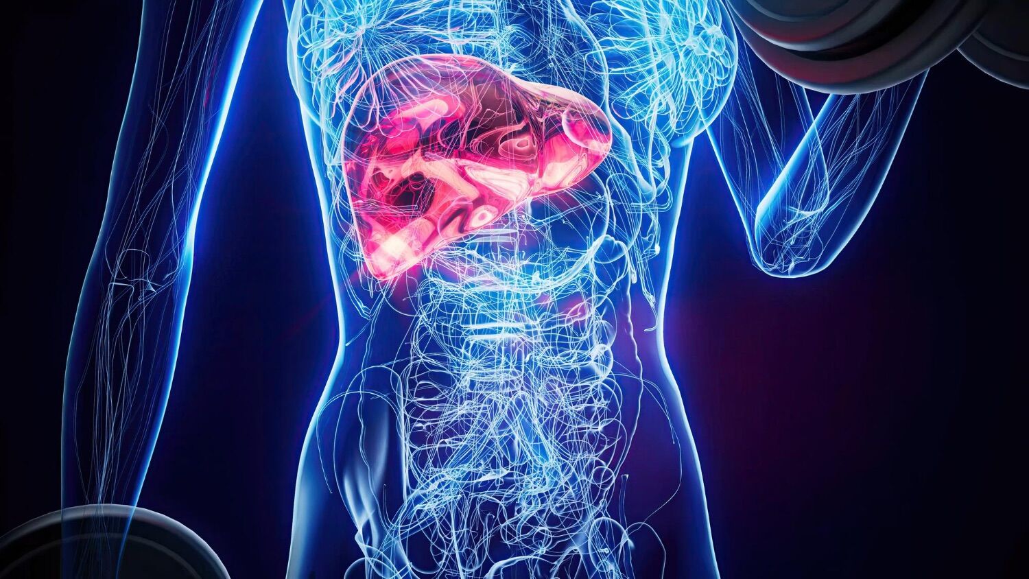 Estudo surpreendente revela o que mata realmente as pessoas com fígado gordo
