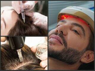 Clínica Sanabria redefine o tratamento capilar com tecnologia e precisão médica