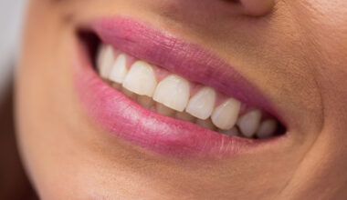 saiba o que comer para ter menos problemas de gengiva