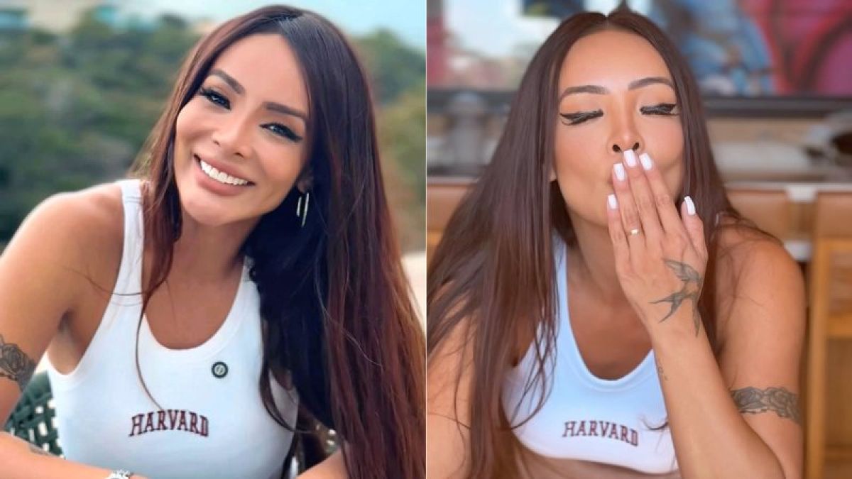 Carol Nakamura rebate críticas por mudanças após plásticas