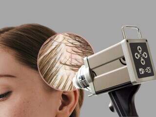 Clínica Sanabria redefine o tratamento capilar com tecnologia e precisão médica