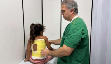 Hospital Infantil Albert Sabin aplica técnica inovadora que utiliza gesso para tratar crianças com escoliose precoce