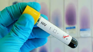 Angola reduz prevalência do VIH/Sida para 1,6%