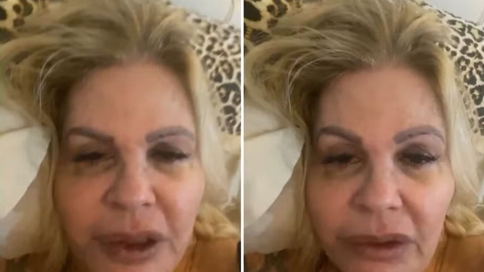 Monique Evans revelou o diagnóstico de dengue em 2024 e atualmente está recuperada - Foto: Reprodução/Instagram