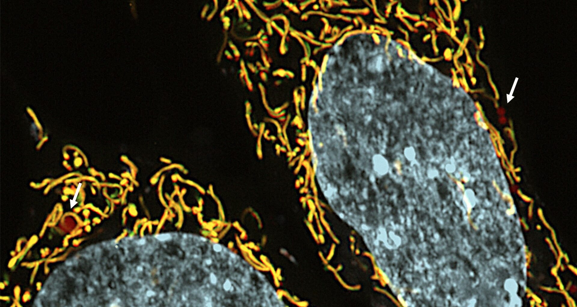 Nova pesquisa aponta terapia para reduzir doenças mitocondriais