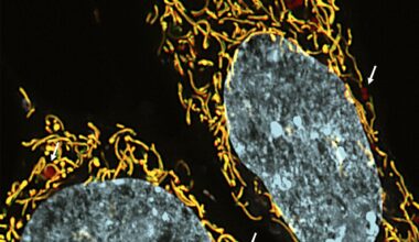 Nova pesquisa aponta terapia para reduzir doenças mitocondriais