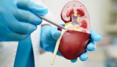 Quais as causas da insuficiência renal aguda Nefrologista explica os 3 tipos e alerta para riscos como desidratação e uso de anti-inflamatórios. Entenda.