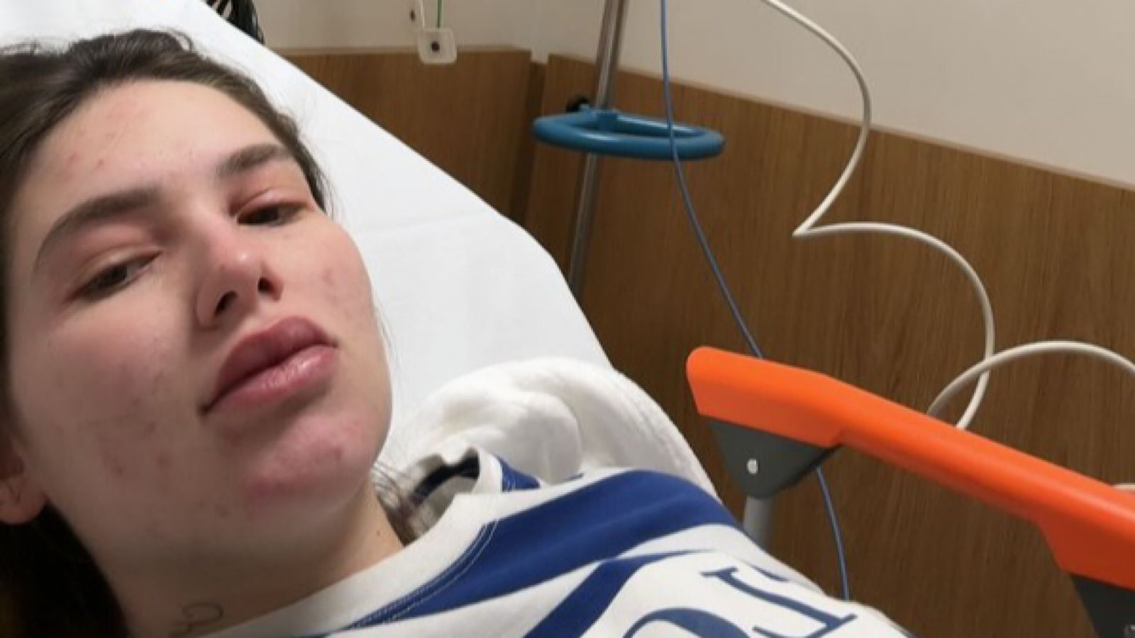 Em 2023, Virginia Fonseca teve o diagnóstico de dengue - Foto: Reproduçao/Instagram @virginia