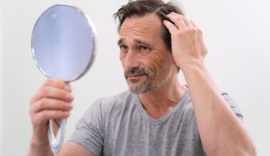 Adoçante natural pode ajudar no tratamento da calvície