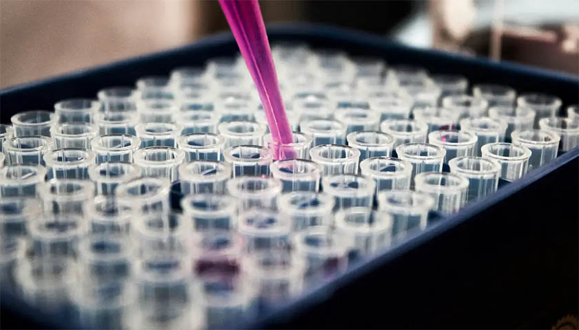 SAÚDE. Pesquisas feitas por cientistas brasileiros avançam no diagnóstico para o ‘Mal de Alzheimer’